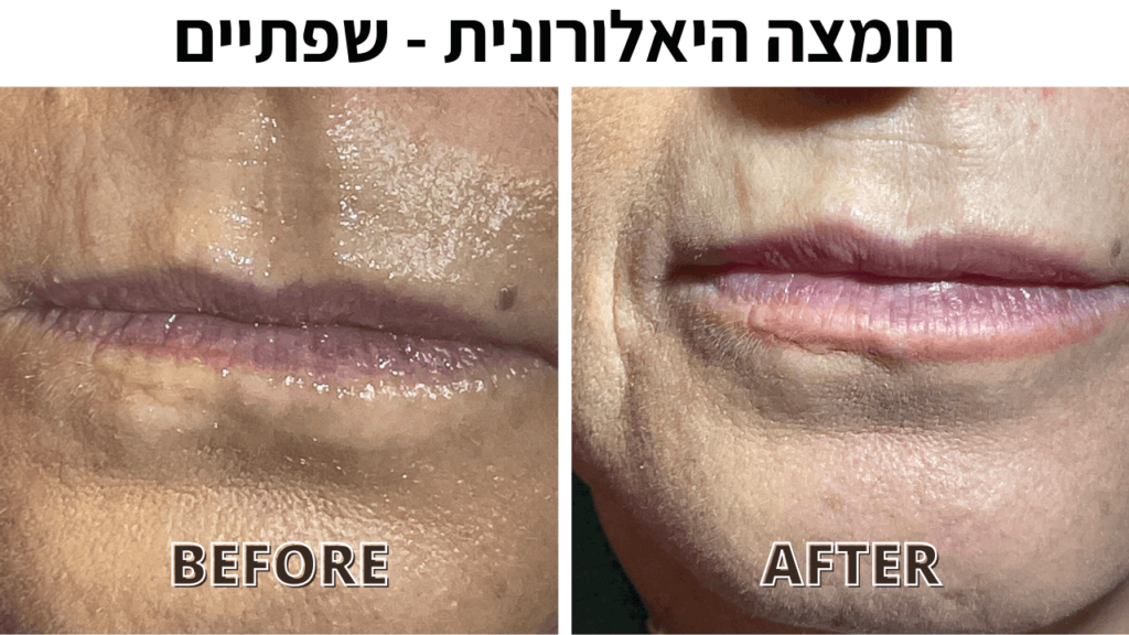 White Black Modern Photo Collage Before After Youtube Thumbnail 2